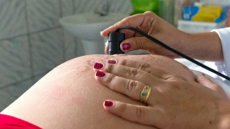 Risco de morte materna cai até 31% entre quem recebe o Bolsa Família