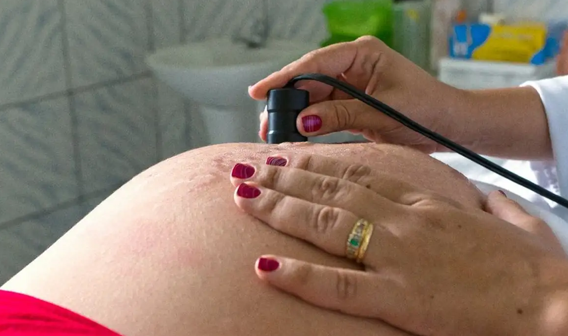Risco de morte materna cai até 31% entre quem recebe o Bolsa Família