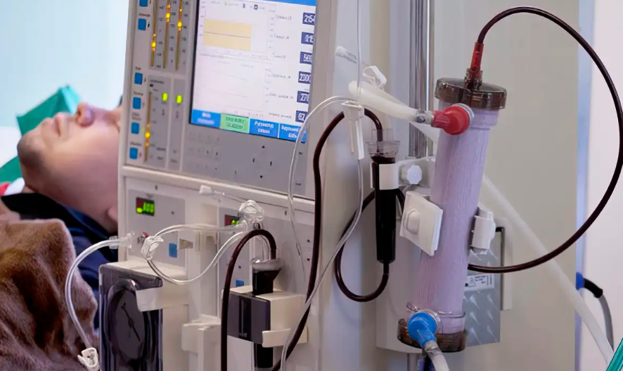 Estudo alerta para subdiagnóstico da doença renal crônica no Brasil